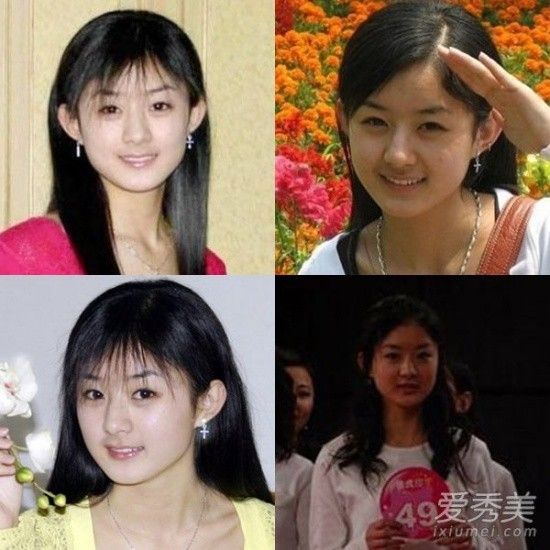 Năm 2006, khi mới tham dự cuộc thi tìm kiếm tài năng, gương mặt Triệu Lệ Dĩnh khác đáng kể so với bây giờ. Những người hâm mộ bênh vực cho rằng, cô đẹp lên nhờ giảm cân. Nhưng trang Cri cho rằng, nữ diễn viên đã nhờ đến thẩm mỹ để có gương mặt đẹp hơn.